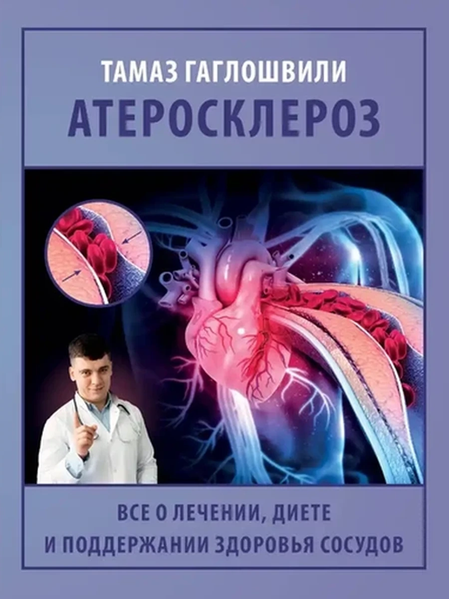 Атеросклероз. Все о лечении, диете и поддержании здоровья сосудов Гаглошвили /АСТ/